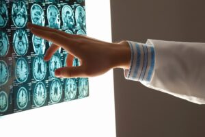 TBI lawyer in St. Louis, MO
